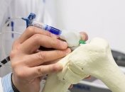 Биоручка позволит "дорисовывать" кости прямо во время операции