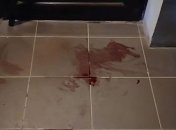 Кровавая дуэль: в Одесской области на улице открыли стрельбу (Видео)