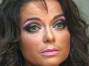 Поклонники Натальи Королевой напуганы ее внешним видом