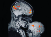 Вся правда о МРТ-снимке матери и ребенка, который гуляет по сети
