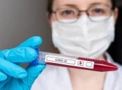 МОЗ повідомляє: В Україні зафіксовано 1318 нових випадків COVID-19