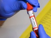 На Буковині 53 пацієнта чекають на результати тестів на коронавірус