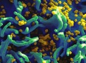 Ребенок, которого вылечили от СПИДа, снова болен