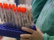 У Києві за добу виявили понад півсотні нових хворих на Covid-19