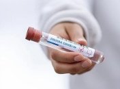 У школьника обнаружили COVID-19: в Запорожье класс идет на карантин