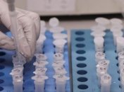 В ЦОЗ рассказали - какова летальность от COVID-19 у людей старше 50 лет в Украине