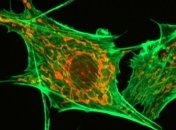 Ученые нашли "переходное звено" между прокариотами и эукариотами