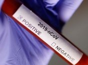 Минздрав: COVID-19 подтвержден у пятерых украинцев за рубежом