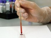 В Украине утверждены стандарты лечения ВИЧ по стандартам ВОЗ