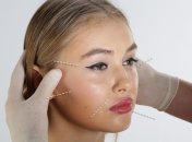 Відомі зірки, яких кардинально змінила пластика (Фото)