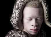 Южноафриканский фотограф делает потрясающие фотографии альбиносов 