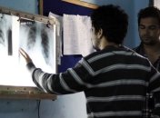 Ученые: туберкулез возник в Африке еще 70 тысяч лет назад