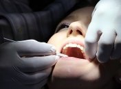 Кривые зубы могут быть опасны для вашего здоровья