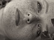 Веснушки - красота, от которой мы избавляемся 