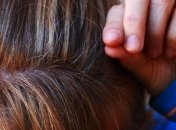 Седые волосы: причины появления ранней седины