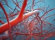 Как почистить кровеносные сосуды в домашних условиях?