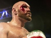 Отец Тайсона Фьюри раскритиковал сына после кровавой победы