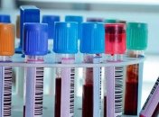 У Києві за добу коронавірус підтвердили у 24 осіб