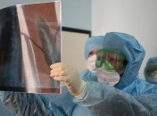 Пандемия COVID-19: число больных коронавирусом в мире превысило 1,6 млн