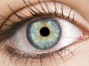 Покраснение глаз и как с этим бороться