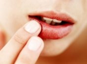 Опасен ли герпес во время беременности