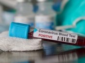 Ситуация ухудшается: в Украине очередной антирекорд по COVID-19