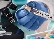 В Киеве за сутки - 65 новых случаев COVID-19