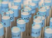 СМИ: Специалисты VADA уже приехали в Украину проверять кандидатов в президенты