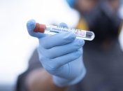 За добу в Україні 418 нових випадків коронавірусу