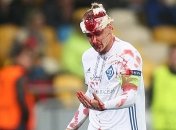 Вида пропустит матч с "Шахтером"