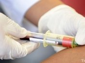 Больные СПИДом отказываются лечиться