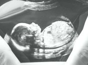 "Теряем" до рождения: у человеческого эмбриона присутствуют мышцы животных