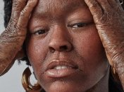 С кожей "рептилии": модель ошеломила сеть своими фотографиями