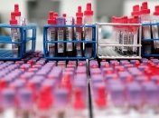 Коронавирус в монастыре на Хмельнитчине: в Шепетовском районе запретили посещать храмы