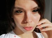 Польська Інстаграм-модель втратила зір через тату на обличчі