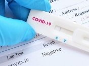 Украине стоит ввести быстрый локдаун: что гласит статистика COVID-19