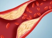 Натуральные средства для очищения сосудов от холестерина