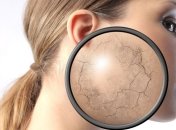 Что делать, если шелушится кожа на лице