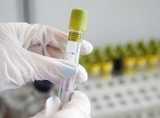 В Украине продолжает увеличиваться прирост COVID-19