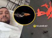 Одежду охранника прошили пули. Появились первые фото Стерненко из больницы и подробности о его состоянии