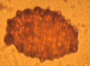 Древние туалетные палочки привели к научному открытию