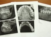 Подтверждена подлинность останков бабушки Михаила Романова