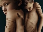 Publicis Pixelpark представили мощную рекламную кампанию против насилия над детьми