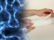 Ученые нашли способ заживлять раны в три раза быстрее: помогло электричество