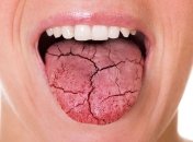 Неприятный привкус во рту может говорить о многих вещах