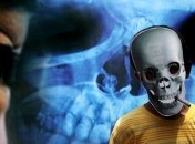 Курение во время беременности повышает риск астмы у двух поколений