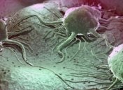 Невероятный прорыв: ученые обнаружили антитело, которое приостанавливает рост опухоли