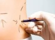 На школьных каникулах - под нож хирурга