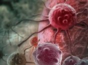 Ученые определили секрет смертельного метастазирующего рака