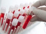 Несколько продуктов, которые повышают уровень гемоглобина